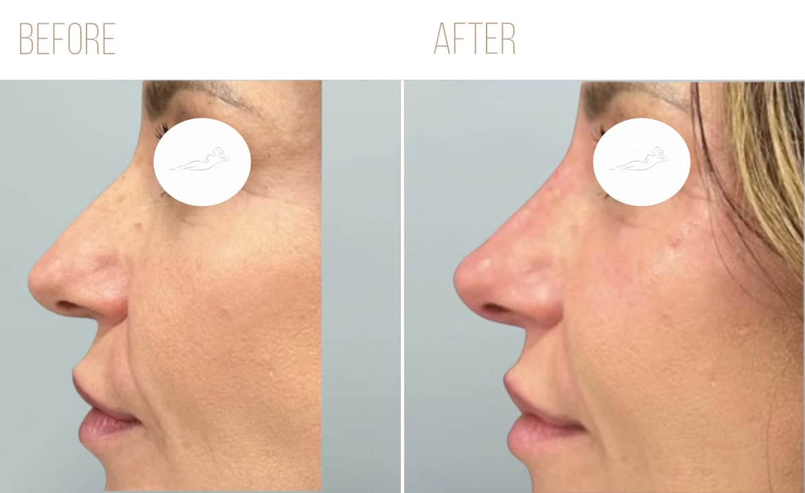 Before and after example