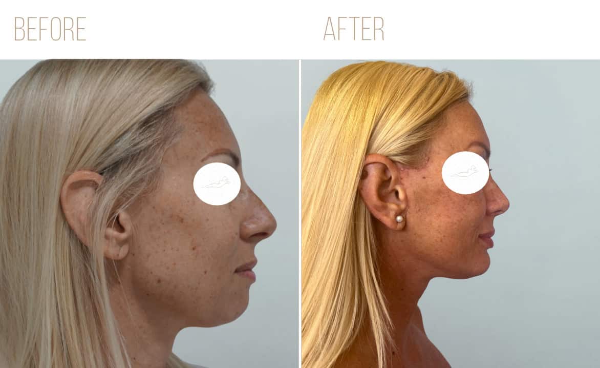 Before and after example