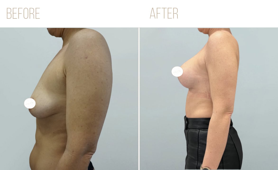 Before and after example