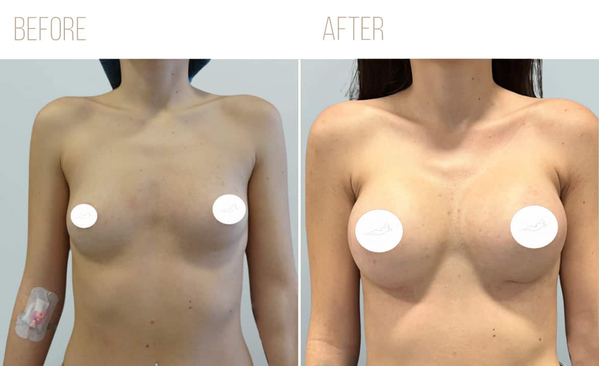 Before and after example