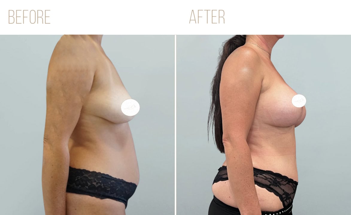 Before and after example