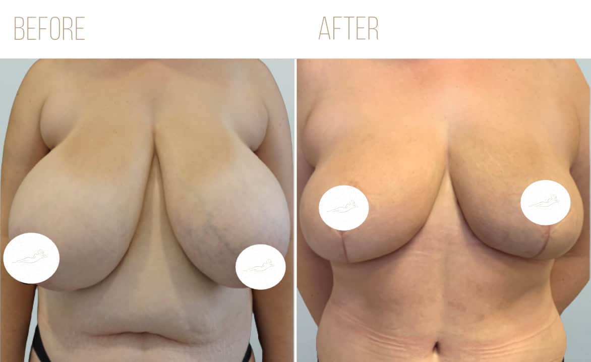 Before and after example